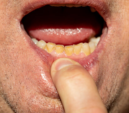 Close-up of person's open mouth