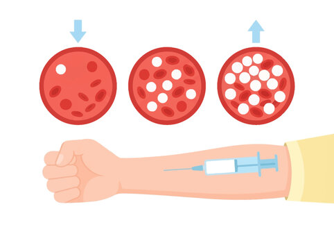Medical Infographic of White Blood Cell Count Increase After Injection