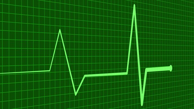 Pulse Monitoring Animation Featuring Digital Medical Heartbeat Line