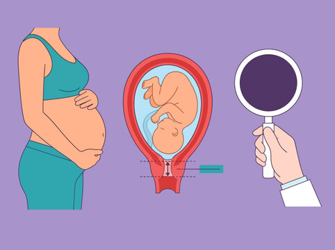 Medical Illustration of Pregnancy and Cervical Examination with Fetus in Womb