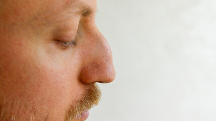 Close up side profile view of man with aquiline nose before rhinoplasty surgery © eliyashevskiy