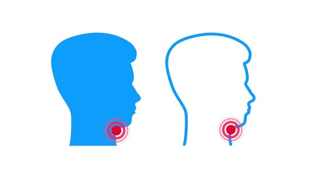 Human sore throat medical treatment animation