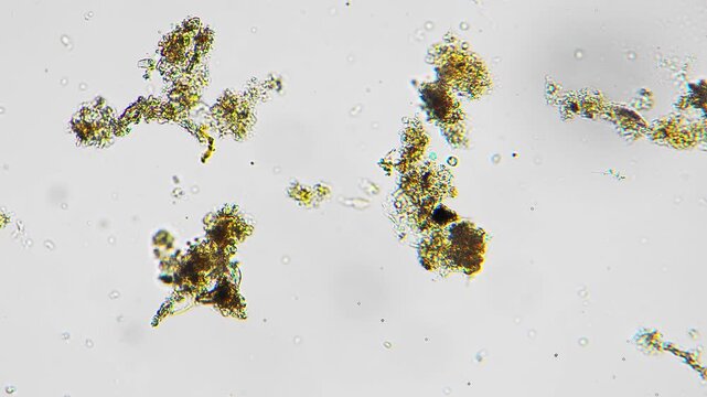 Microscopic algae clusters forming irregular brown clumps, aggregated biofilm fragments, complex textures and particulate matter, brightfield imaging of pond sample for environmental monitoring