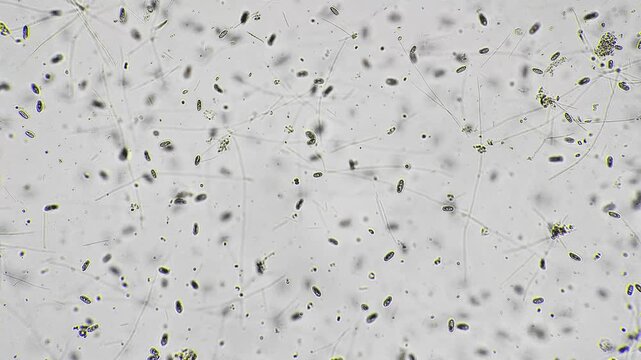 Slide exhibits evenly spread small cells suitable for counting and analysis. Microscopic image demonstrating uniform dispersion of microorganisms across slide for laboratory evaluation