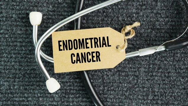 Stethoscope and paper tag with the words Endometrial cancer is a type of cancer that begins in the endometrium, which is the inner lining of the uterus womb. It is the most common type of gynecologica