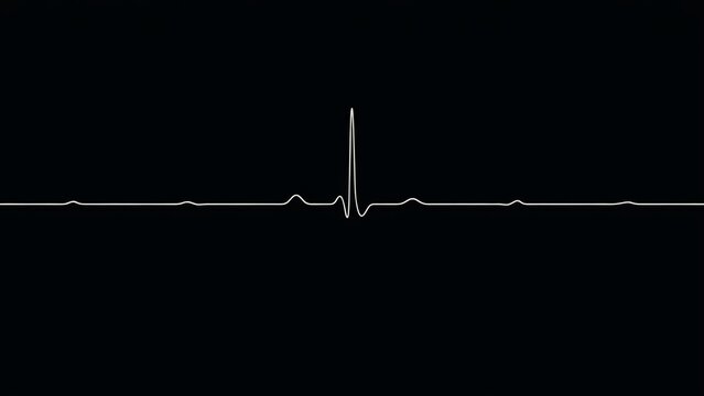 Single heartbeat ekg line on black background, representing a medical pulse rhythm or cardiac health monitoring concept