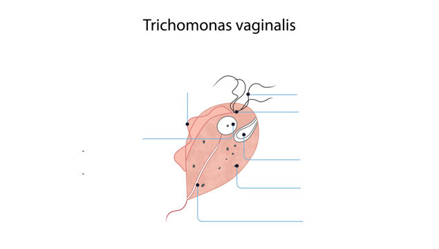  Trichomonas vaginalis, Scientific medical illustration of Trichomonas vaginalis, a motile flagellated protozoan responsible for trichomoniasis, showing its characteristic pear-shaped body