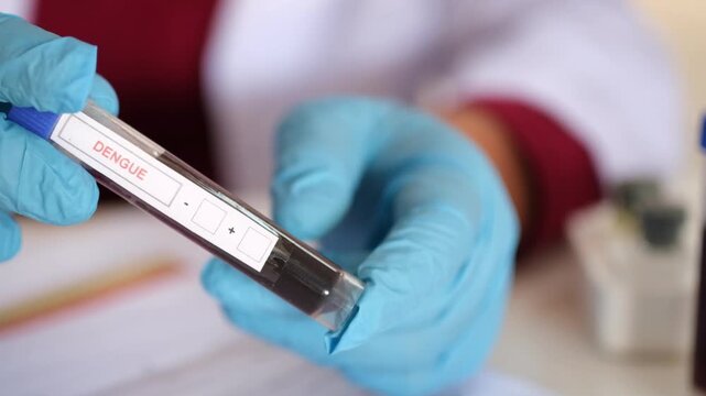 A doctor or laboratory technician holds a test tube containing a blood sample from a patient with Dengue fever; a medical and healthcare concept. Efforts regarding the treatment and prevention of Deng