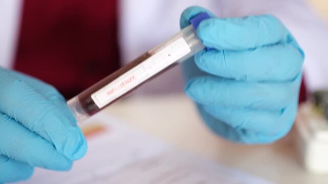 A doctor holds a blood sample from an influenza patient; a lab test is used to confirm the diagnosis.