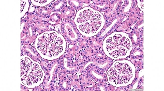 Microscopic view of human kidney tissue showing renal corpuscles and glomeruli with kidney biopsy glomerulus histology cellular