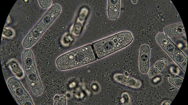 Microscopic view of fission yeast cells undergoing cell division in a laboratory setting.