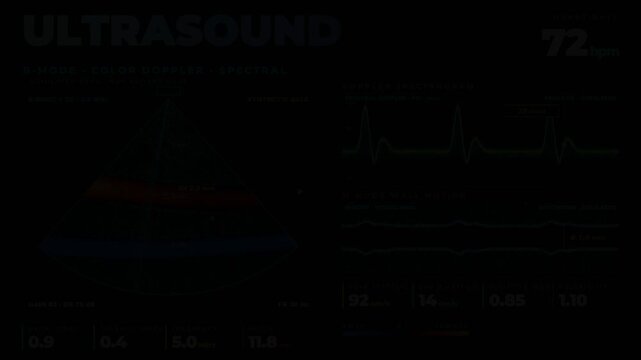 Ultrasound medical monitor dashboard showing doppler spectrogram and heart rate telemetry for clinical diagnostic presentations.