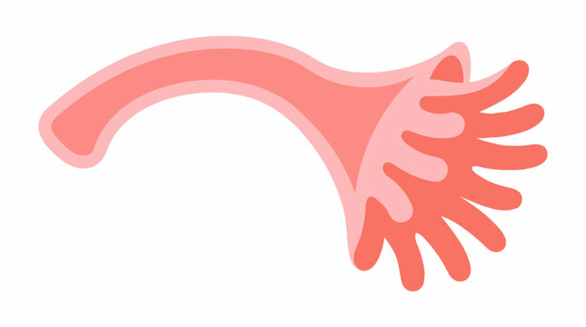 Medical illustration of human fallopian tube anatomy showing infundibulum with fimbriae