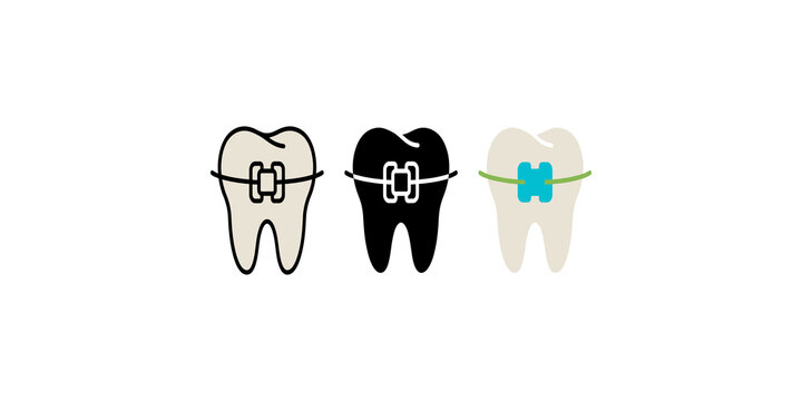 Dental tooth with braces vector illustration showing orthodontic treatment options for perfect teeth alignment.