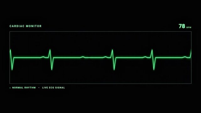 Digital Cardiac Monitor Showing Normal Heartbeat ECG Graph on Dark Screen