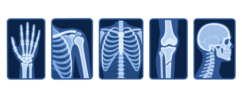 X-ray body parts illustration