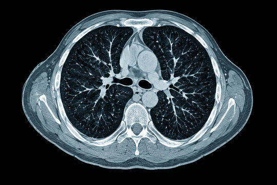 AI-generated photorealistic 3D medical illustration of ct scan chest axial on dark background, created for healthcare education and commercial design.