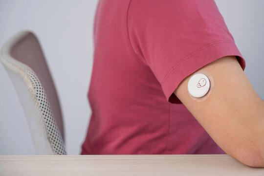 Faceless woman with a continuous glucose monitor. 