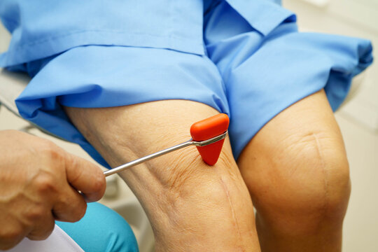 Asian doctor knock on knee reflex nerve for check and treatment senior patient in hospital.
