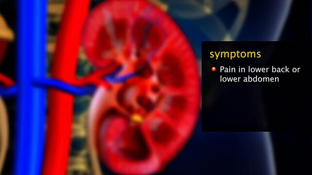 Renal calculi may cause severe flank pain, bloody urine, painful urination, nausea, urgency, and obstruction.