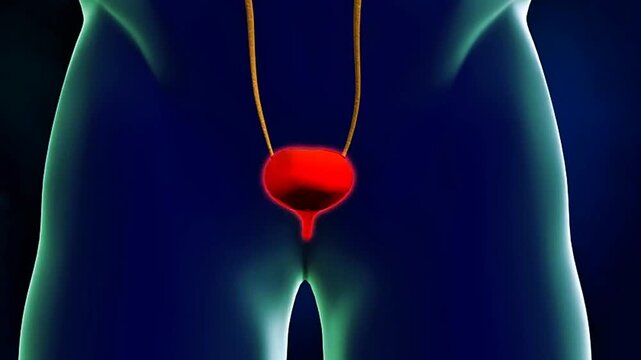 Excretory disorders may result from infections, genetics, diabetes, hypertension, toxins, stones, and dehydration.