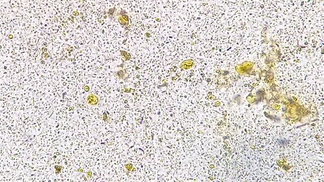 Cysts of giardia lamblia and bacteria in stool. Microscopic footage of stool. 