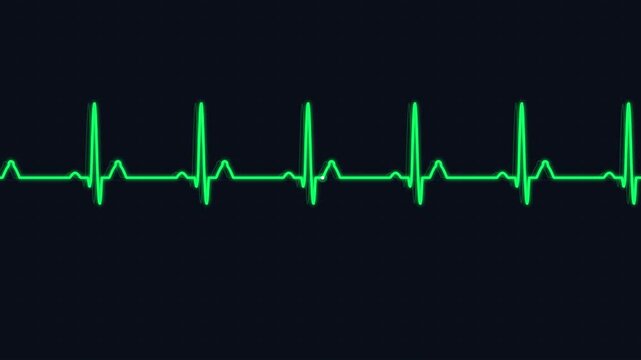 Heartbeat EKG motion, transparent background, looping pulse graphic