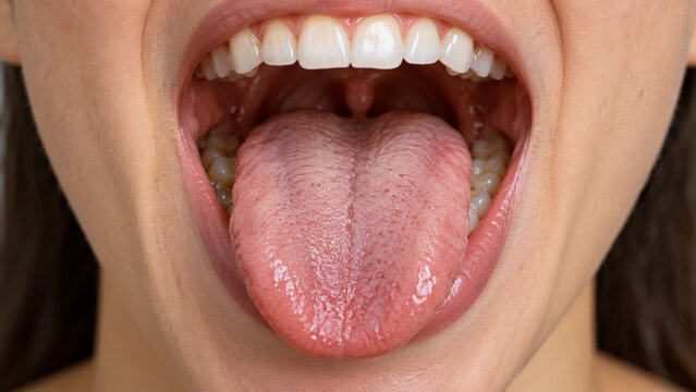 Close Up of Open Mouth Showing Healthy Human Tongue Teeth and Oral Cavity. Concept of oral health, uvula, throat.