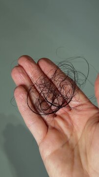 Woman showing a handful of shed dark hair collected after brushing or showering. Close-up highlighting hair thinning, excessive hair fall and concerns about female hair loss.
