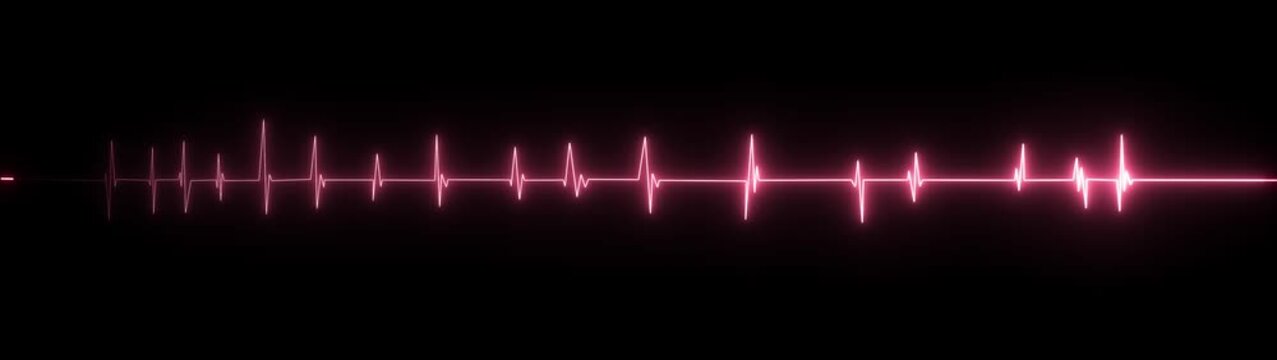 A vivid pink electrocardiogram line pulses across a dark black background, showcasing a dynamic sequence of sharp peaks and dips that signify a fluctuating heart rhythm, with the central portion