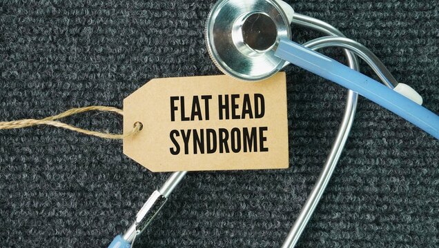 Stethoscope and paper tag with the words Flat head syndrome describes a misshapen infant skull caused by prolonged pressure on soft baby bones. It is a common, generally harmless condition that does