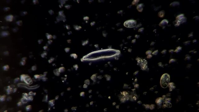 Microscopic view of diatoms and microorganisms swimming in pond water, darkfield microscopy