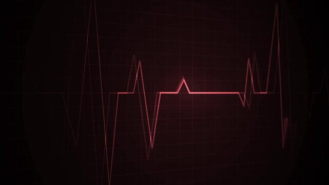 Heartbeat line on a grid pulse pattern for health medicine and emergency monitoring animation
