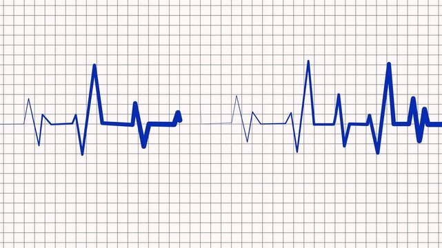 Heartbeat line on graph paper showing an ecg style rhythm pattern animation