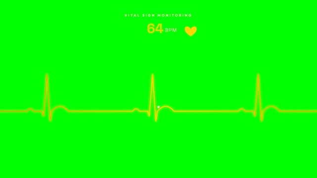Premium Gold Ecg Pulse Waveform 64 Bpm Healthcare Green Screen Overlay for Smart Factory Telemetry and Sustainable Production Line