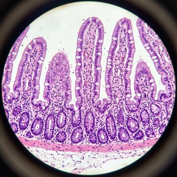 Mammalian Small Intestine Villi Histology Light Micrograph Showing Mucosal Epithelium And Absorption Architecture For Medical Education   