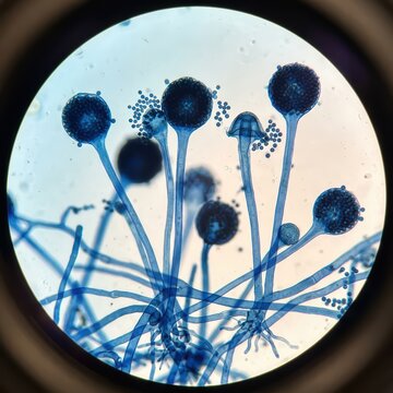 Mycology Light Micrograph Revealing Rhizopus Bread Mold Sporangium And Spore Dispersal Mechanisms For Scientific Studies   