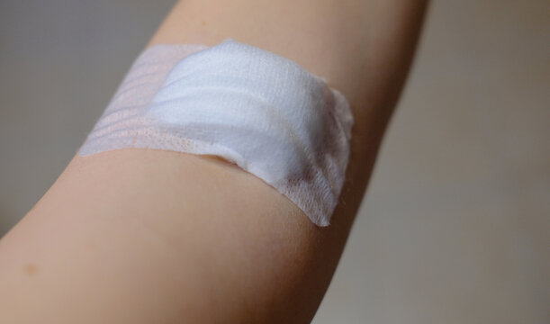 Gauze dressing on the inner elbow after a blood draw. Arm with a gauze dressing at the inner elbow after a blood test