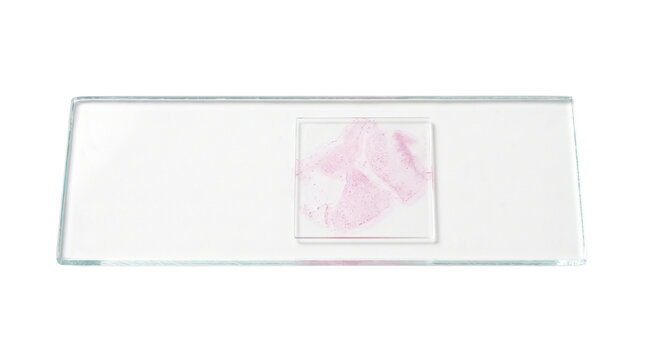 Microscope glass slide with pink stained tissue specimen under cover slip isolated on white background for laboratory science and medical research