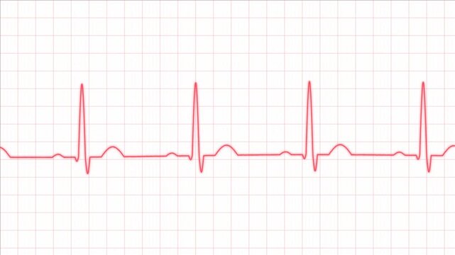 Normal Heartbeat ECG EKG Animation with Red Electrocardiogram Waveform on White Background, Human Heart Rhythm, Cardiac Monitoring, Pulse, Medical Technology and Healthcare