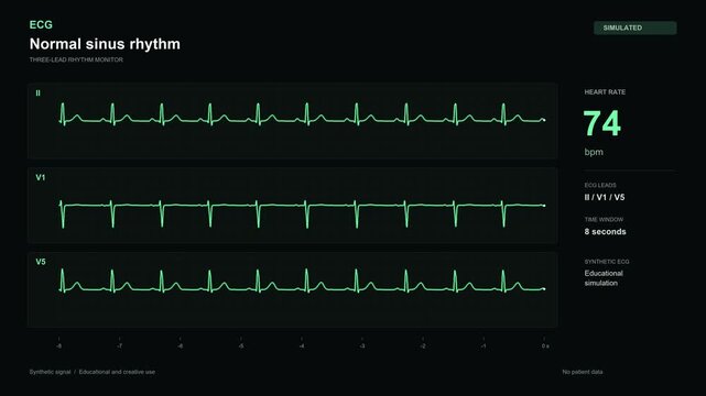 Normal sinus rhythm ECG monitor simulation on black