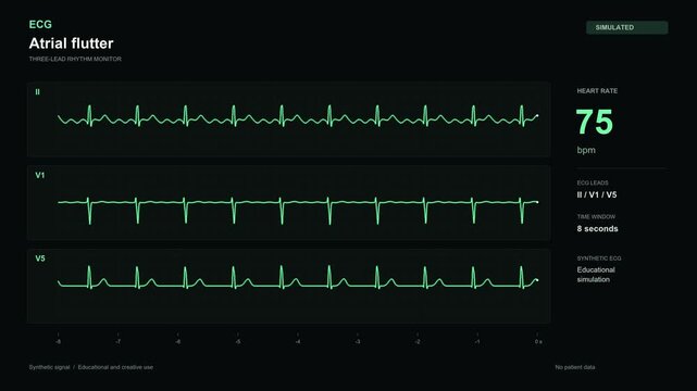 Atrial flutter ECG monitor simulation on black