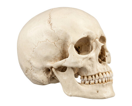 Anatomical view of a human skull showing bone structure and teeth