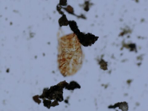A tardigrade drying out and entering the tun state