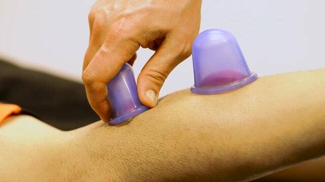 Close up of suction therapy on a paitents leg