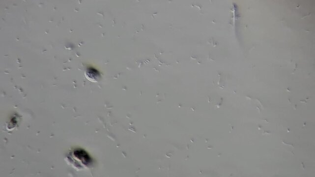 Microscopic view of bacteria and microorganisms swimming in pond water, spirillum and bacilli, 600x magnification