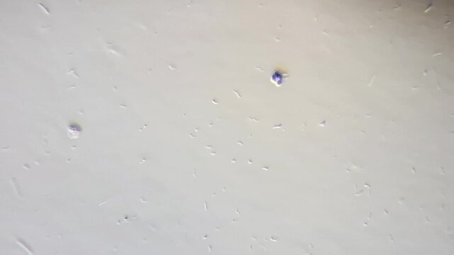 Microscopic view of bacteria and microorganisms swimming in pond water, spirillum and bacilli, 600x magnification