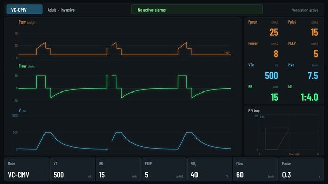 Mechanical Ventilator Screen Pressure Flow Volume Waveforms ICU