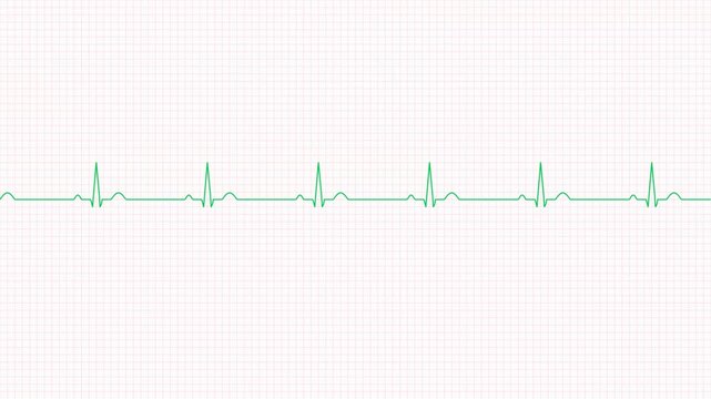 Seamless Heartbeat EKG ECG Line Animation on White Grid Background