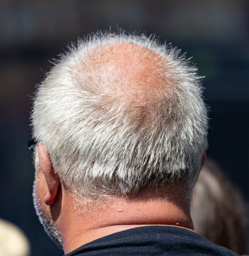 Back view of a man with thinning gray hair